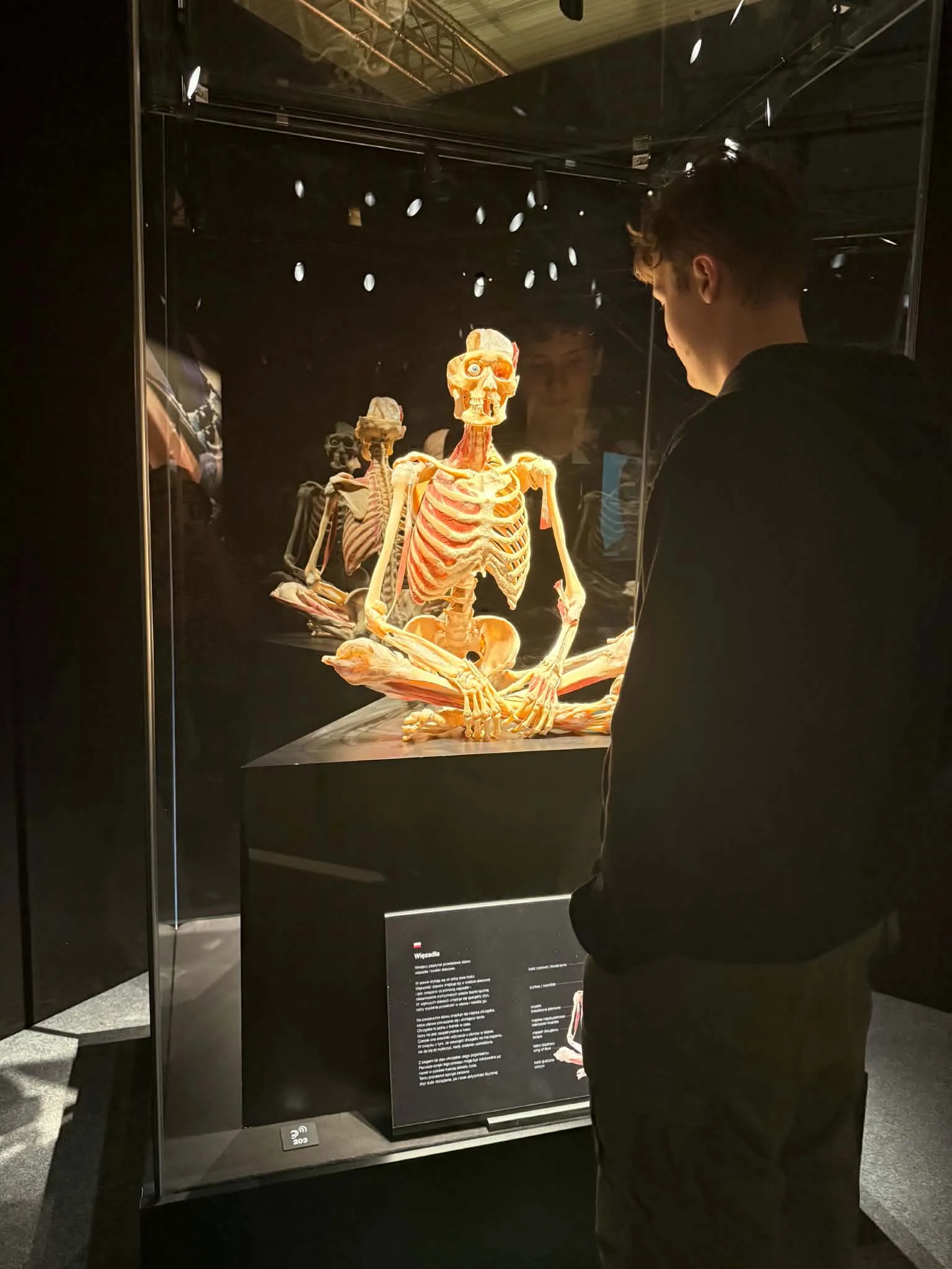 Na wystawie Body Worlds