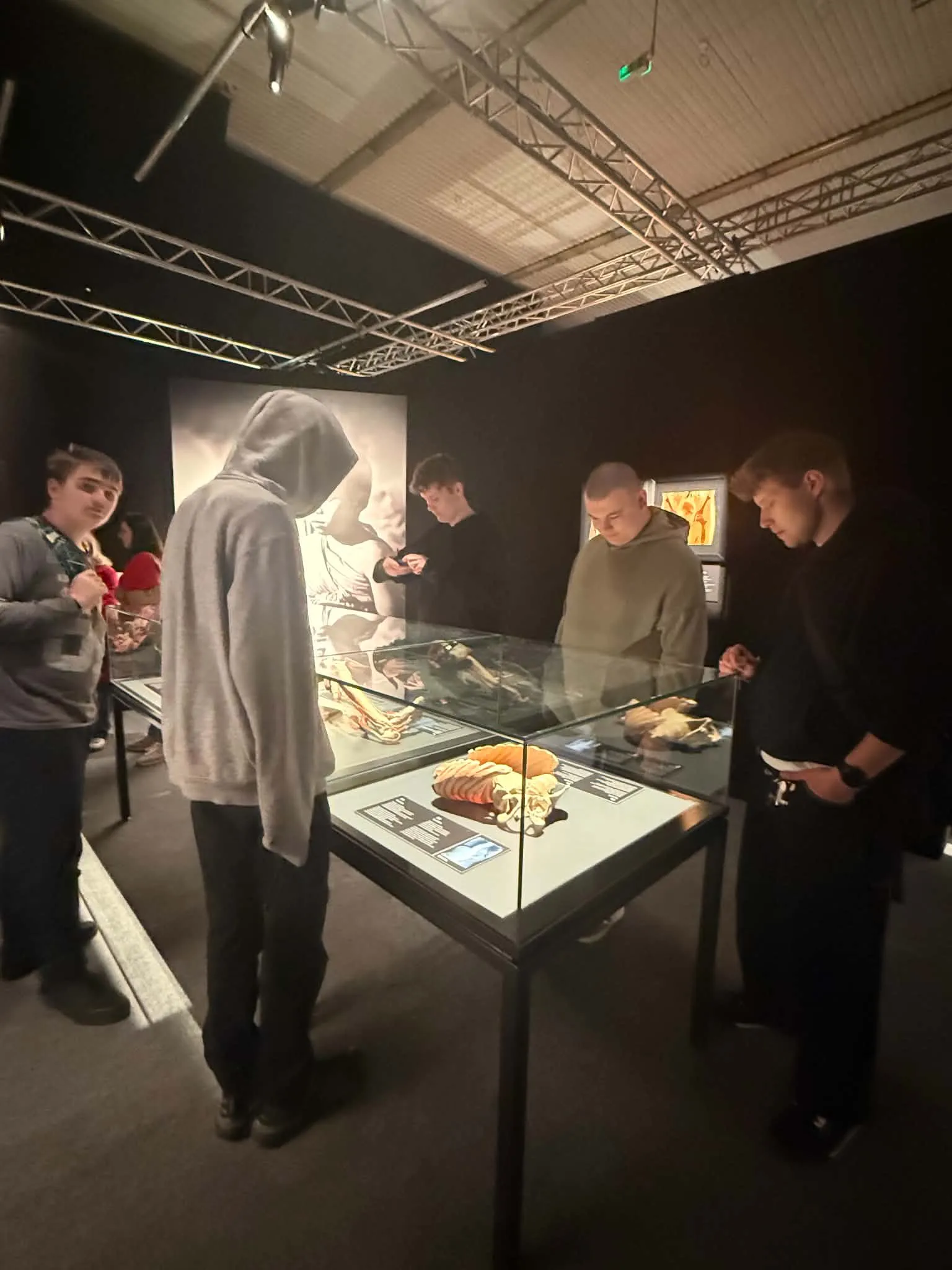 Na wystawie Body Worlds