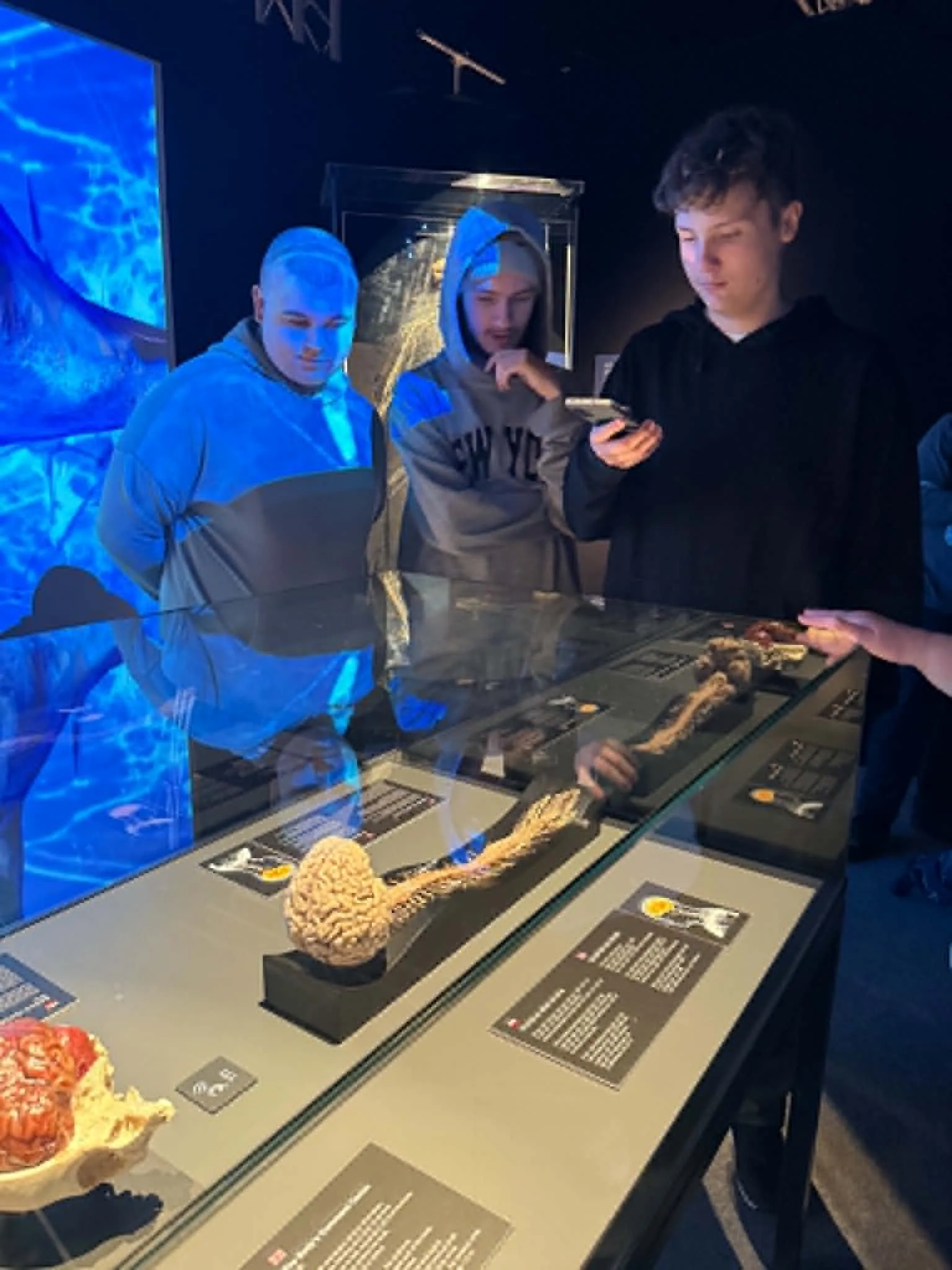 Na wystawie Body Worlds