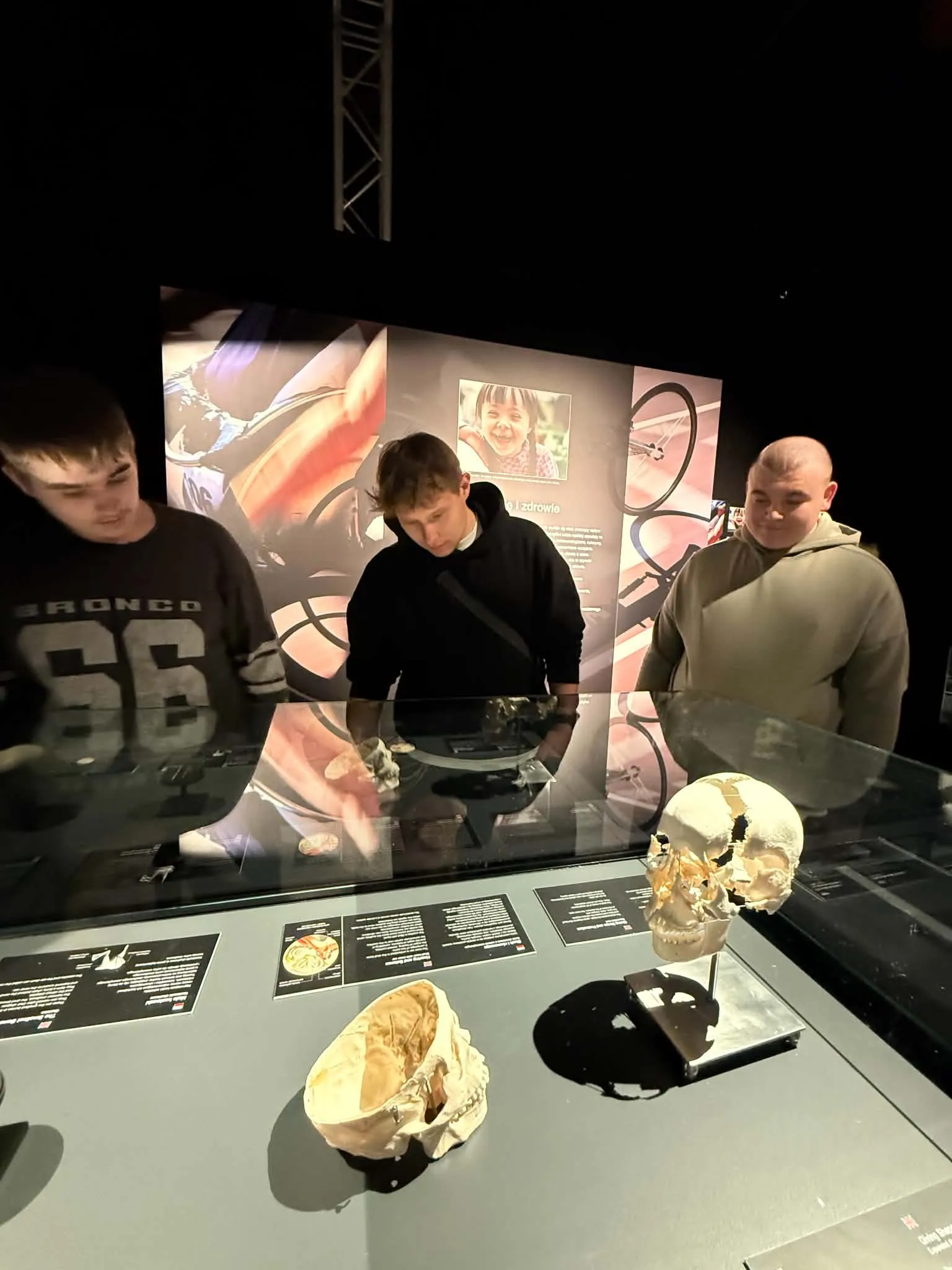 Na wystawie Body Worlds