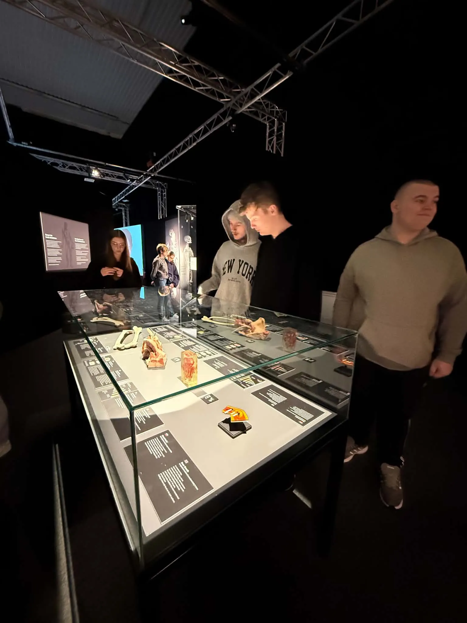 Na wystawie Body Worlds